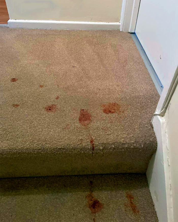 Blood removal cleaning